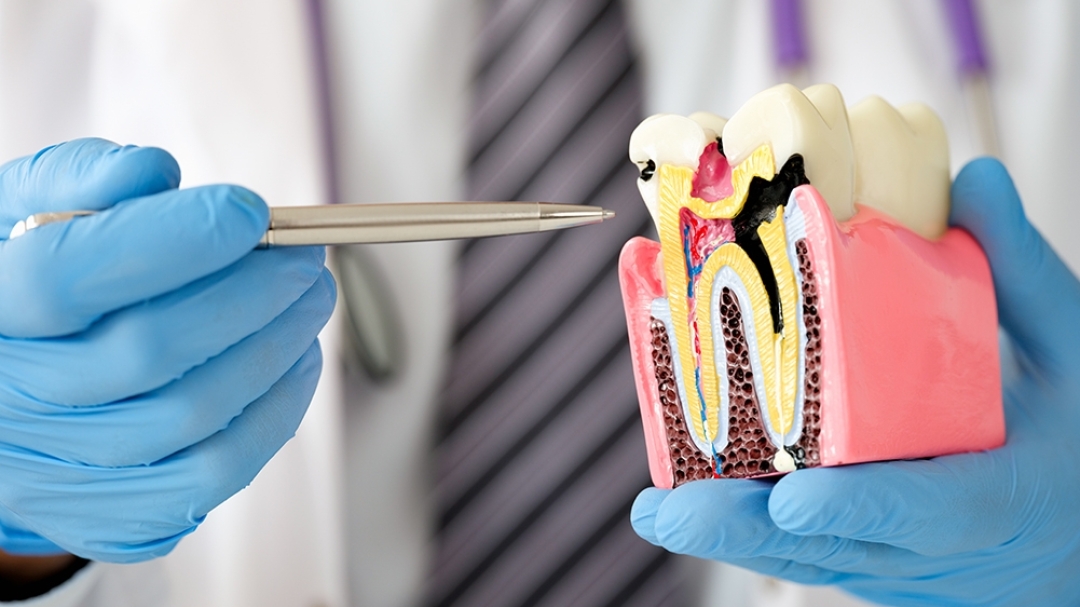 Orthodontic