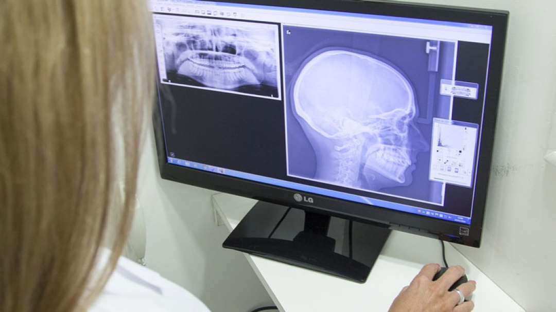 X ray of the jaw 2416943 1920v2