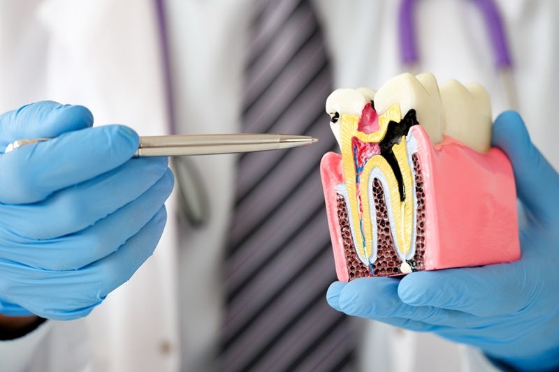 Orthodontic
